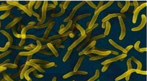 微生物菌劑好？好在哪里您知道嗎？